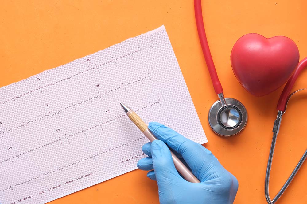 Je lichaam niet overbelasten? Doe een APK met een sportmedisch onderzoek!