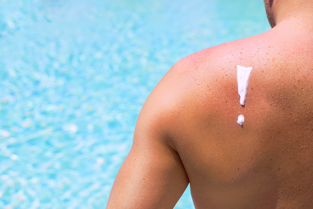 Zon, zwembad en zonnebrand: wat je écht moet weten